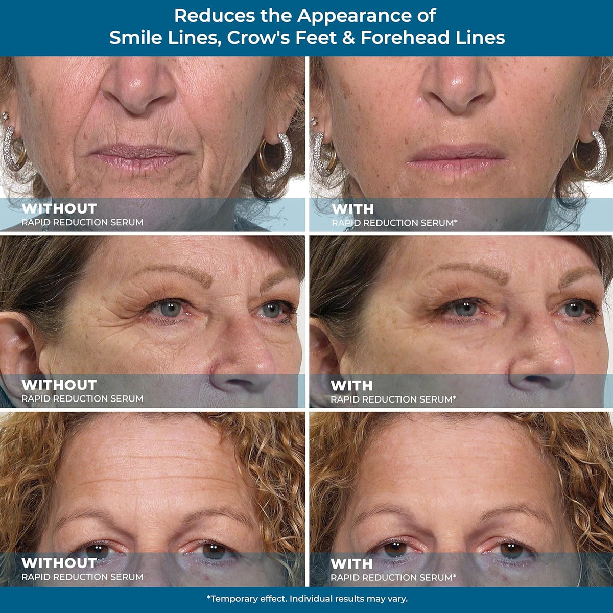 Rapid Reduction Eye Serum D349104